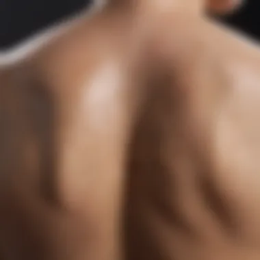 Close-up of exfoliated back skin