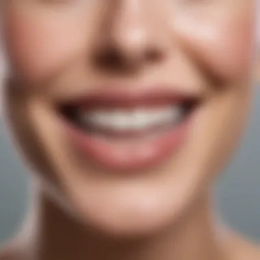 Close-up of a radiant smile after whitening treatment