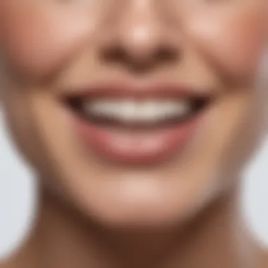 Natural Teeth Whitening Remedies Natural Teeth Whitening Remedies