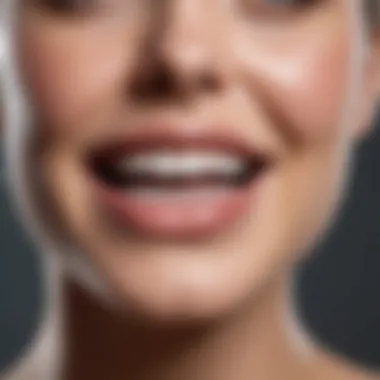 Whitening Gel Application Whitening Gel Application