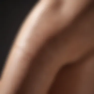 Visual Representation of Stretch Marks on Legs Legs with Stretch Marks