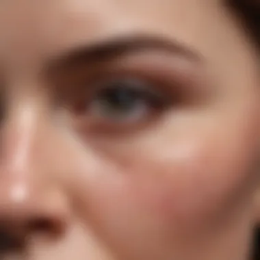 Close-up of irritated skin around the eyes due to eczema allergy