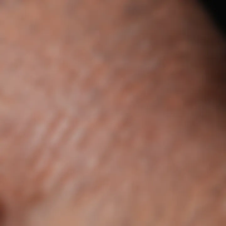 Close-up of flaky scalp skin texture