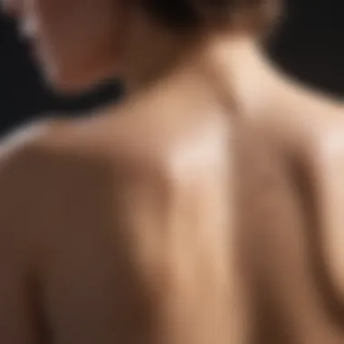 A close-up view of back acne