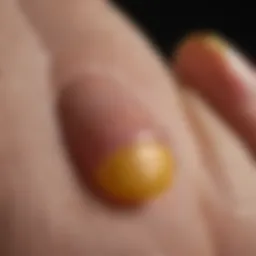 Close-up view of a toenail with yellow discoloration